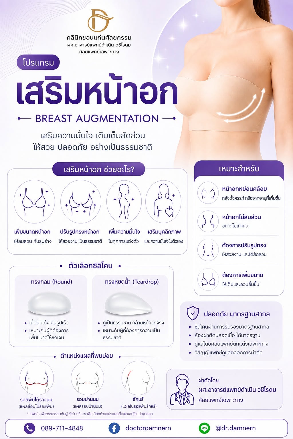โปรแกรมเสริมหน้าอก เลือกซิลิโคนทรงกลมหรือหยดน้ำ ตำแหน่งแผลรอยพับใต้ราวนม รอบปานนม หรือรักแร้ ผ่าตัดโดย ผศ.อาจารย์แพทย์ดำเนิน วชิโรดม คลินิกขอนแก่นศัลยกรรม